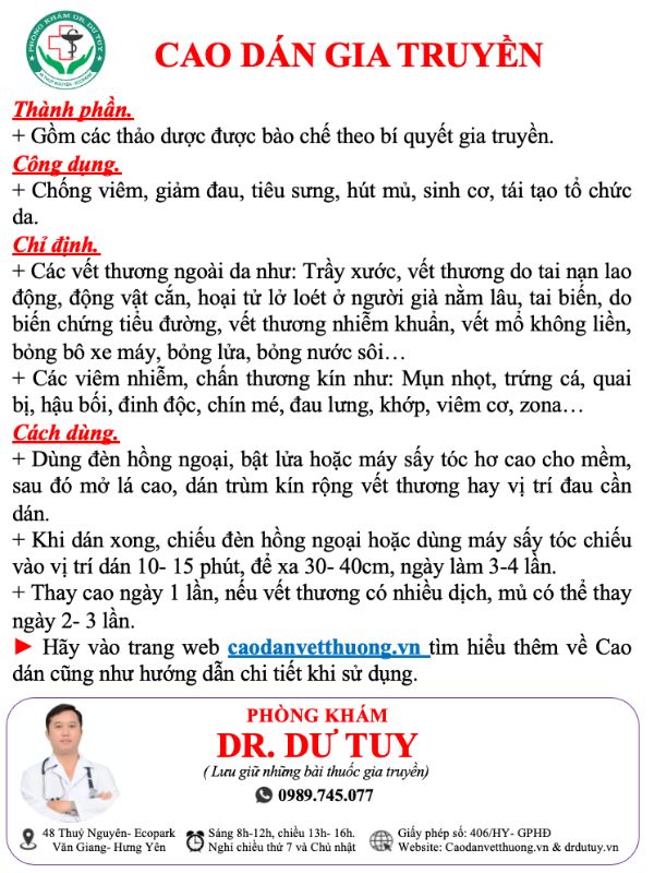 Cao dán gia truyền